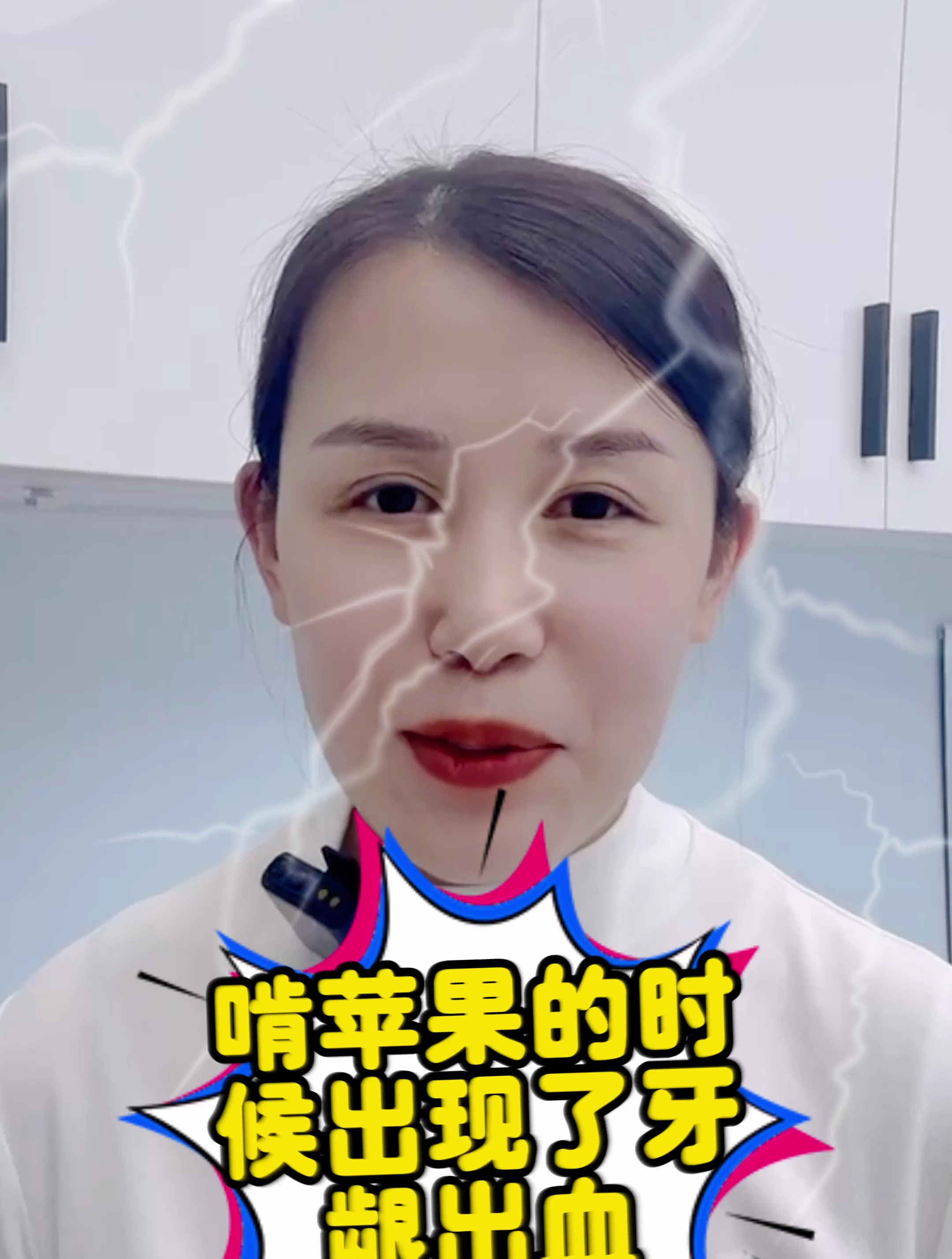 5吃苹果牙龈出血怎么回事