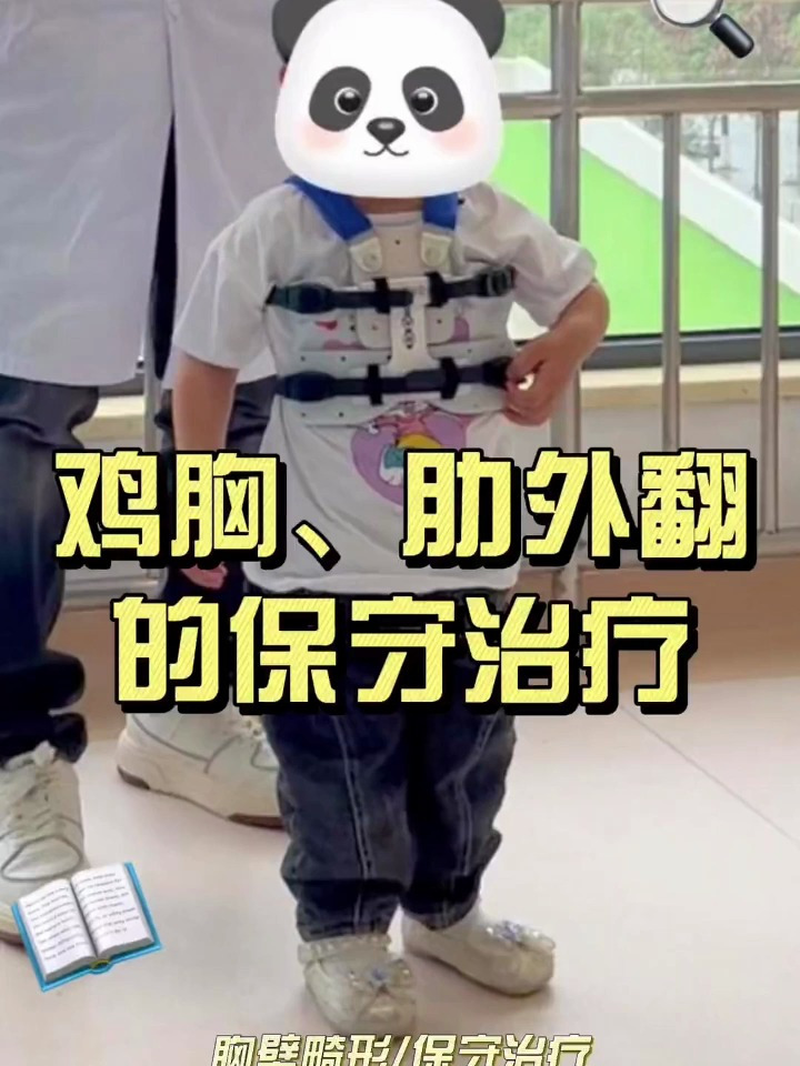 鸡胸、肋外翻的支具治疗