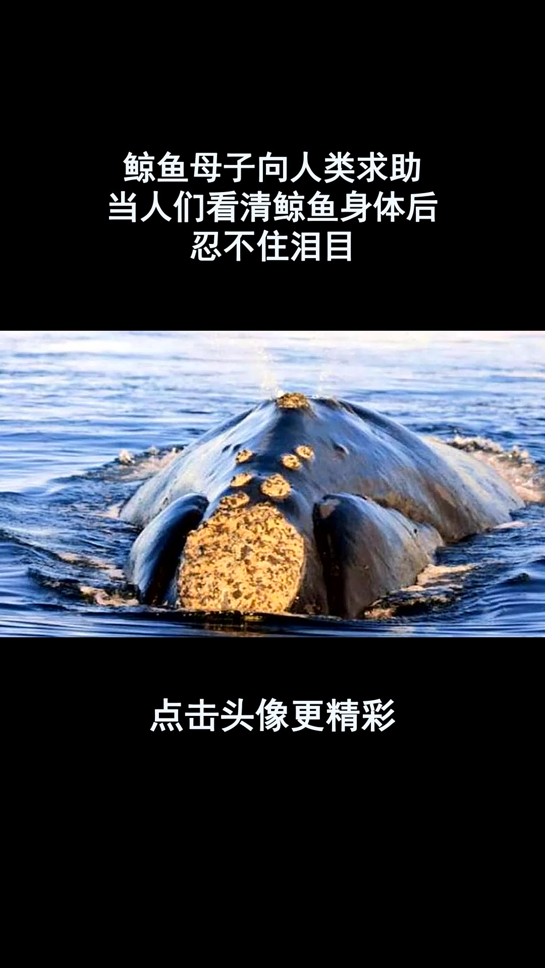 鲸鱼母子向人类求助,当人们看清鲸鱼身体后,忍不住泪目!