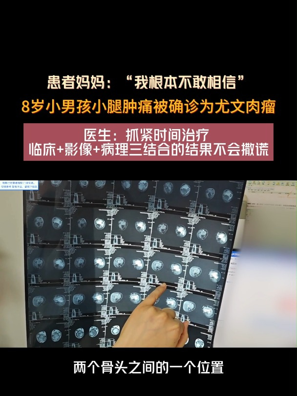 小男孩患尤文肉瘤,妈妈直呼不敢相信!患恶性肿瘤应抓紧时间治疗