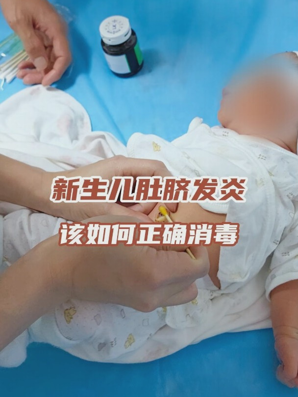 新生儿肚脐发炎,该如何正确消毒?
