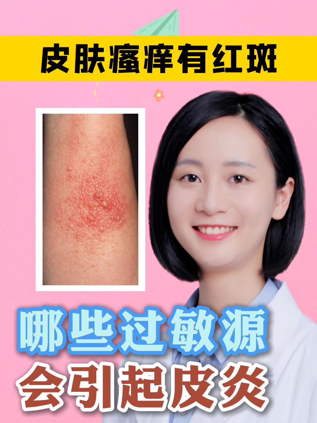 哪些过敏源会引起皮炎?