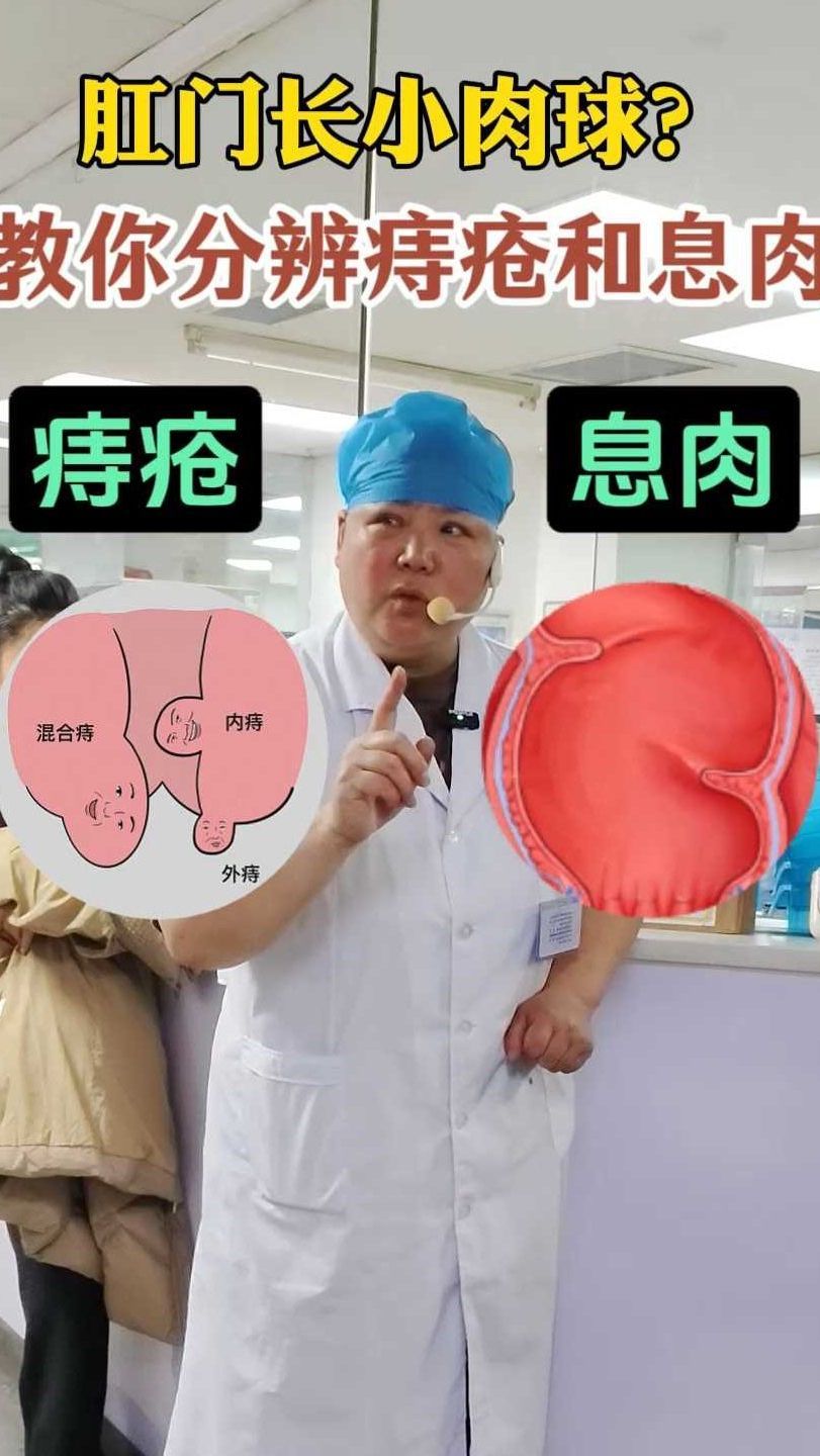肛门长小肉球?教你分辨痔疮和息肉