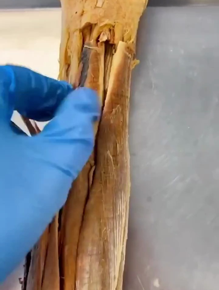 人体标本手臂,手腕处深层肌肉清晰可见
