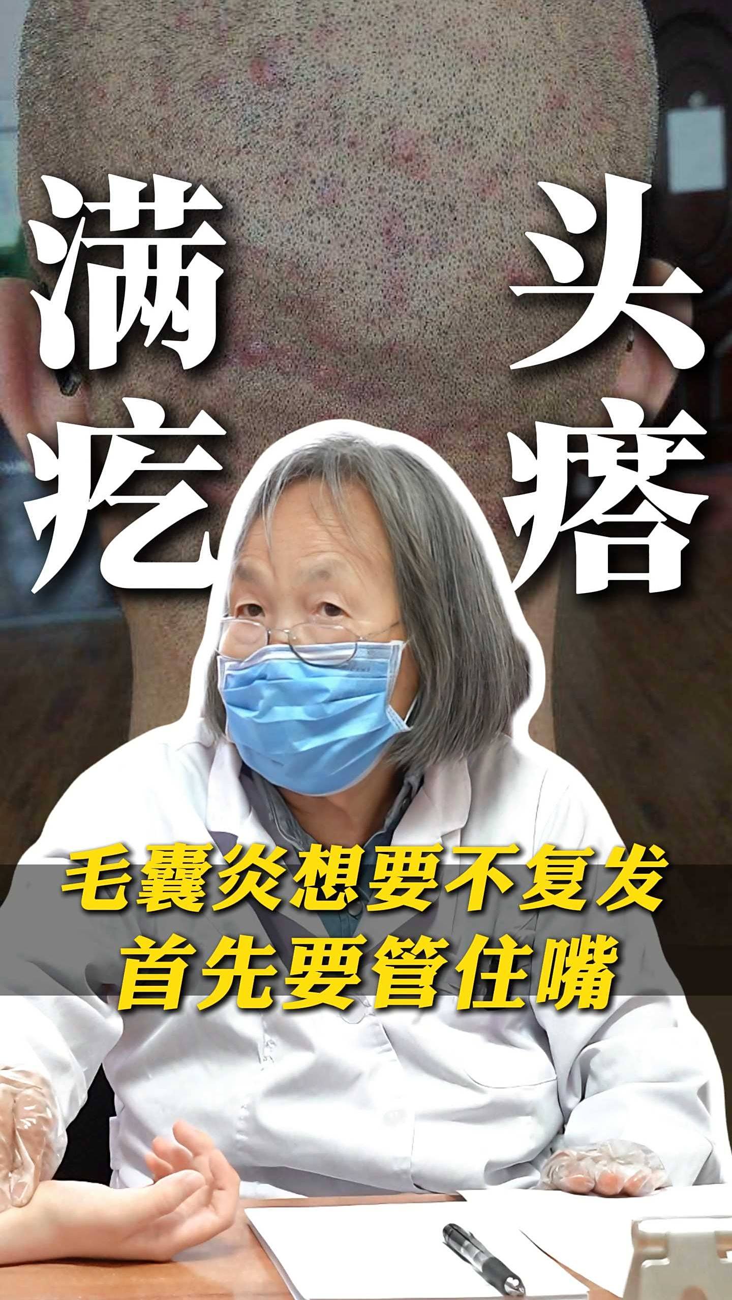 毛囊炎想要少复发,首先要管住嘴!