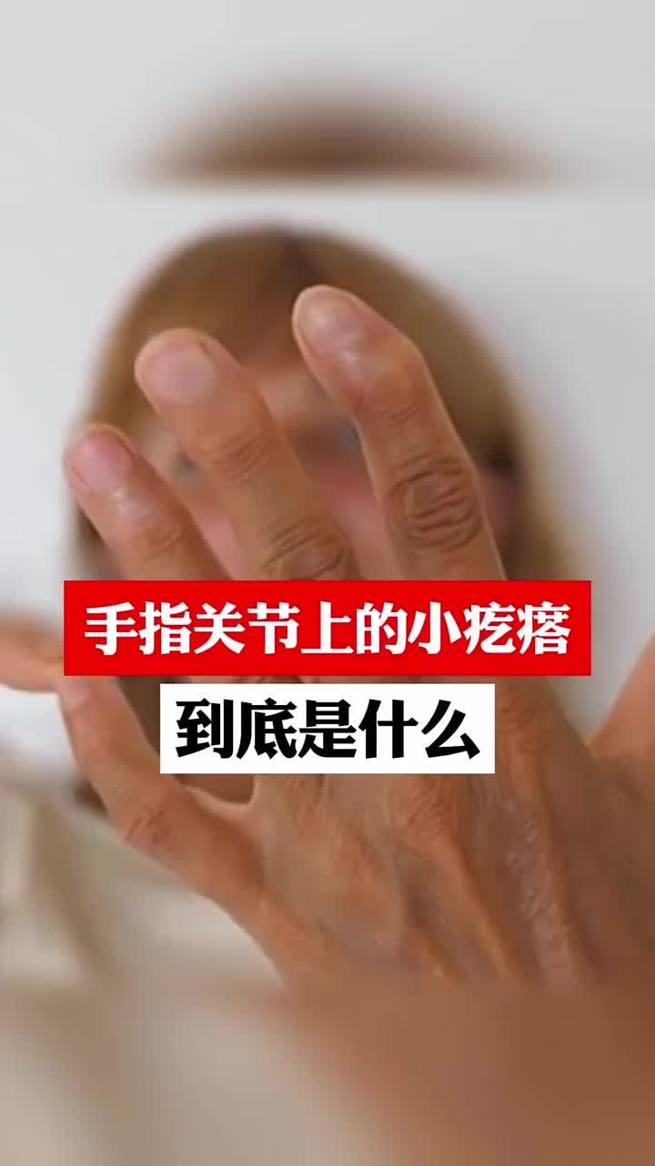 手指关节的小疙瘩到底是什么?
