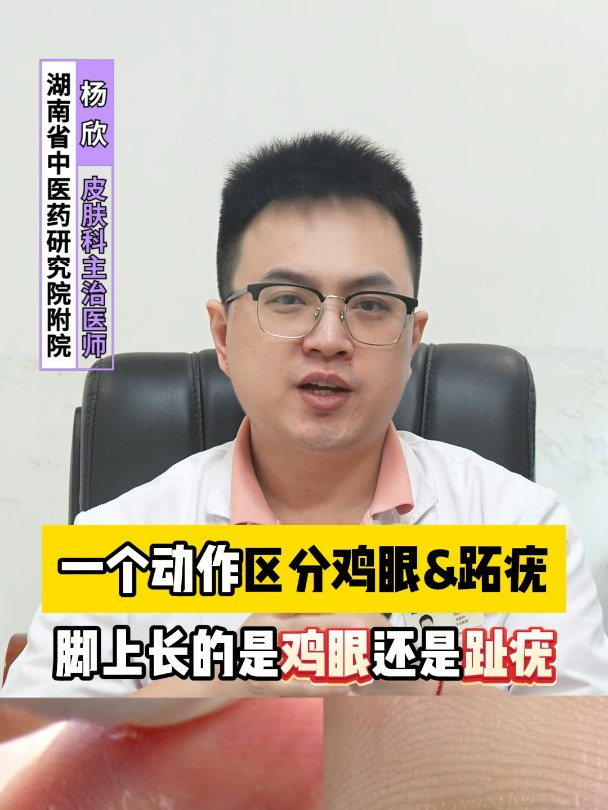 一个动作区分鸡眼和跖疣