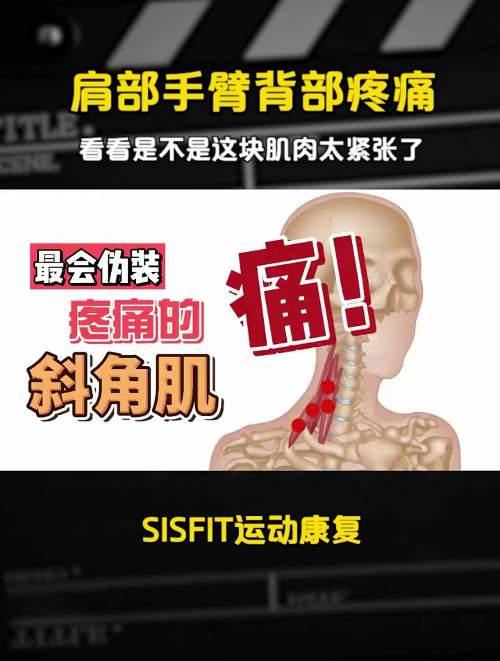 肩部手臂背部疼痛,看看是不是这块肌肉太紧张了