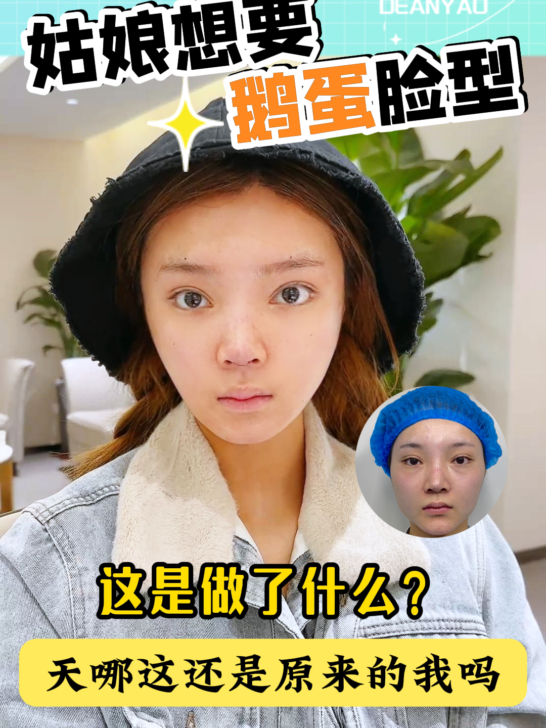 姑娘想要鹅蛋脸,这是做了什么?“天哪!这还是原来的我吗?”