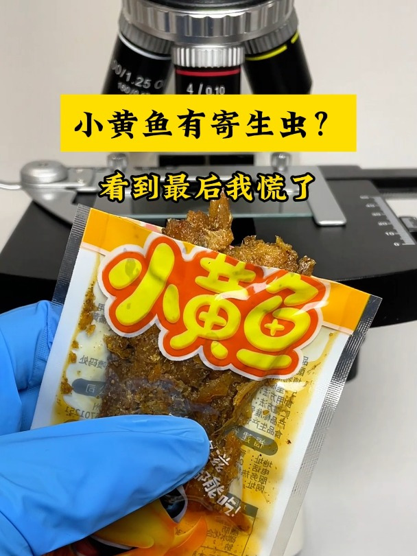 小黄鱼零食有寄生虫?放大500倍我慌了