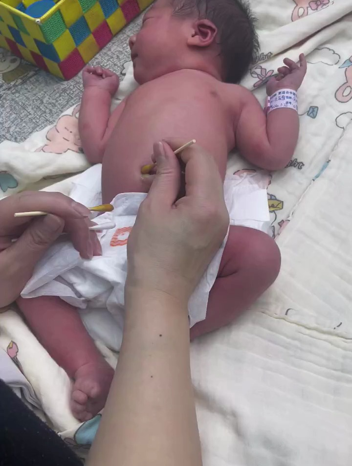 在家这样给宝宝肚脐消毒新生儿肚脐护理十分重要