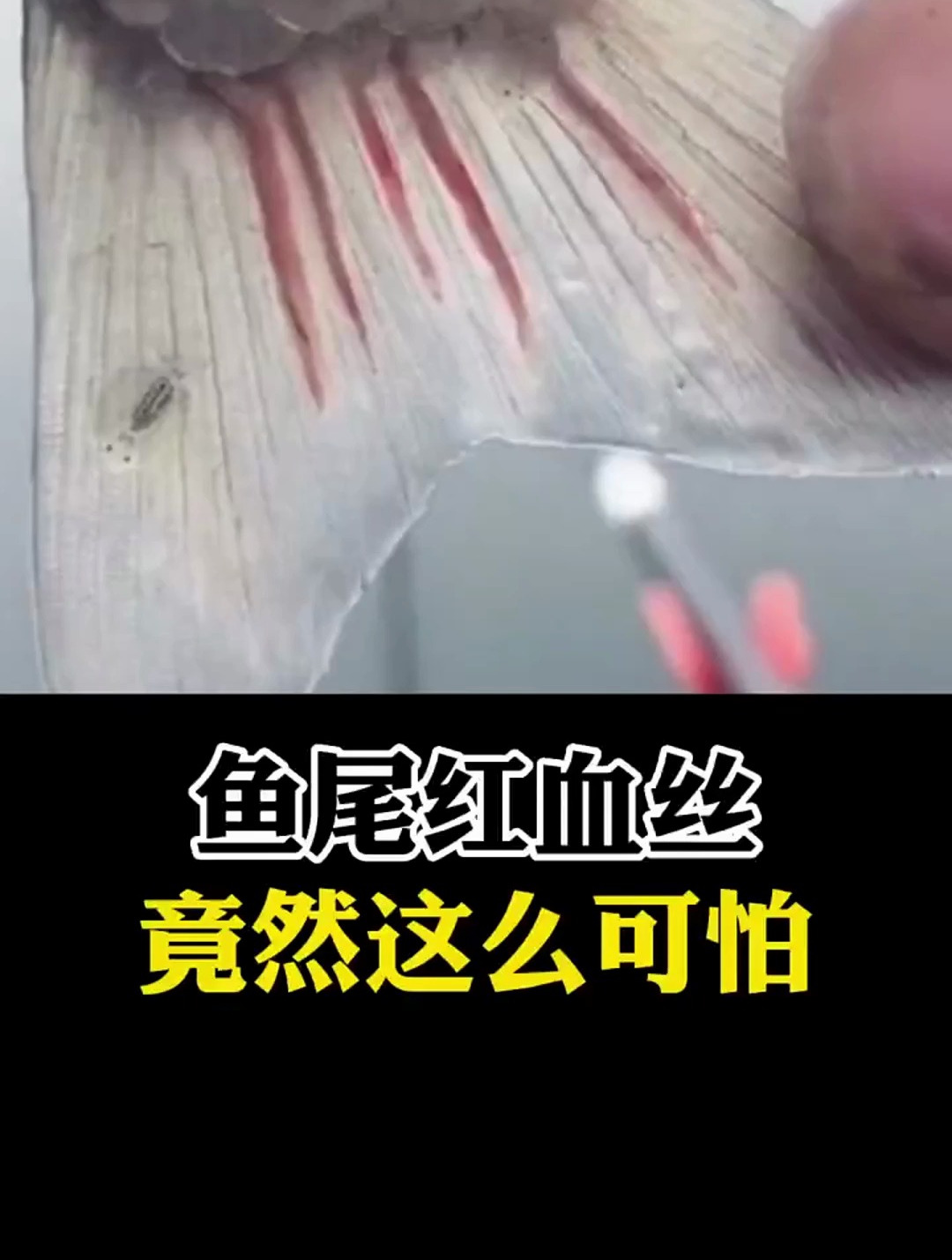 鱼尾红血丝,竟然这么可怕 科普健康