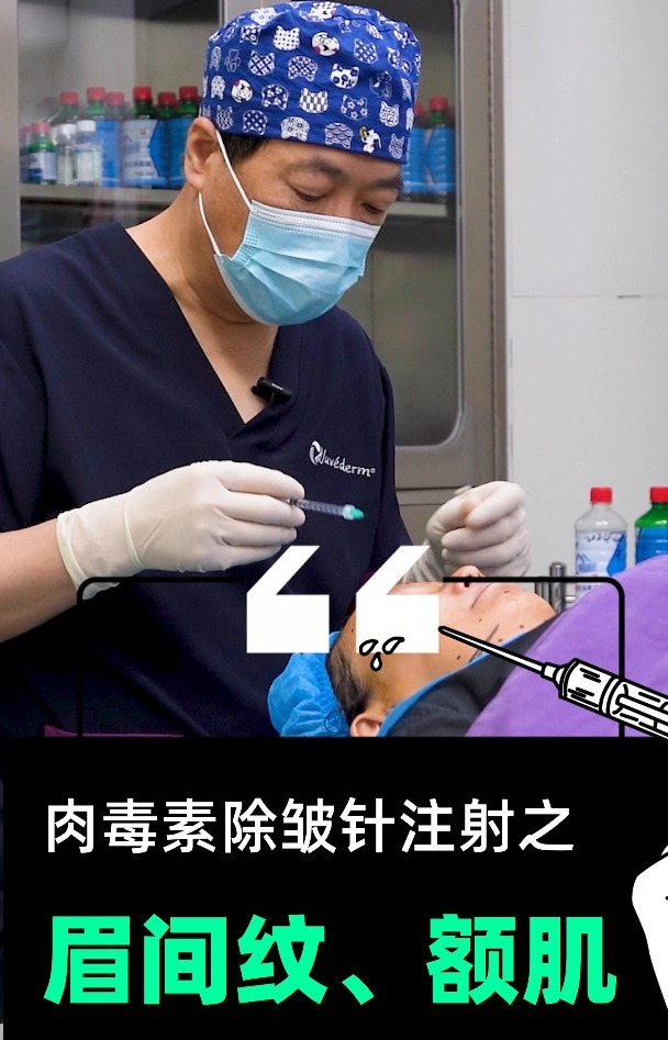 肉毒素注射除皱——眉间纹、额纹