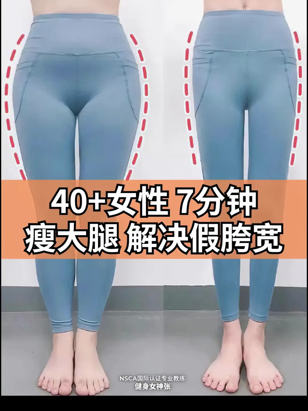 女性大腿外侧突出,如何解决“马鞍肉”脂肪堆积假胯宽等