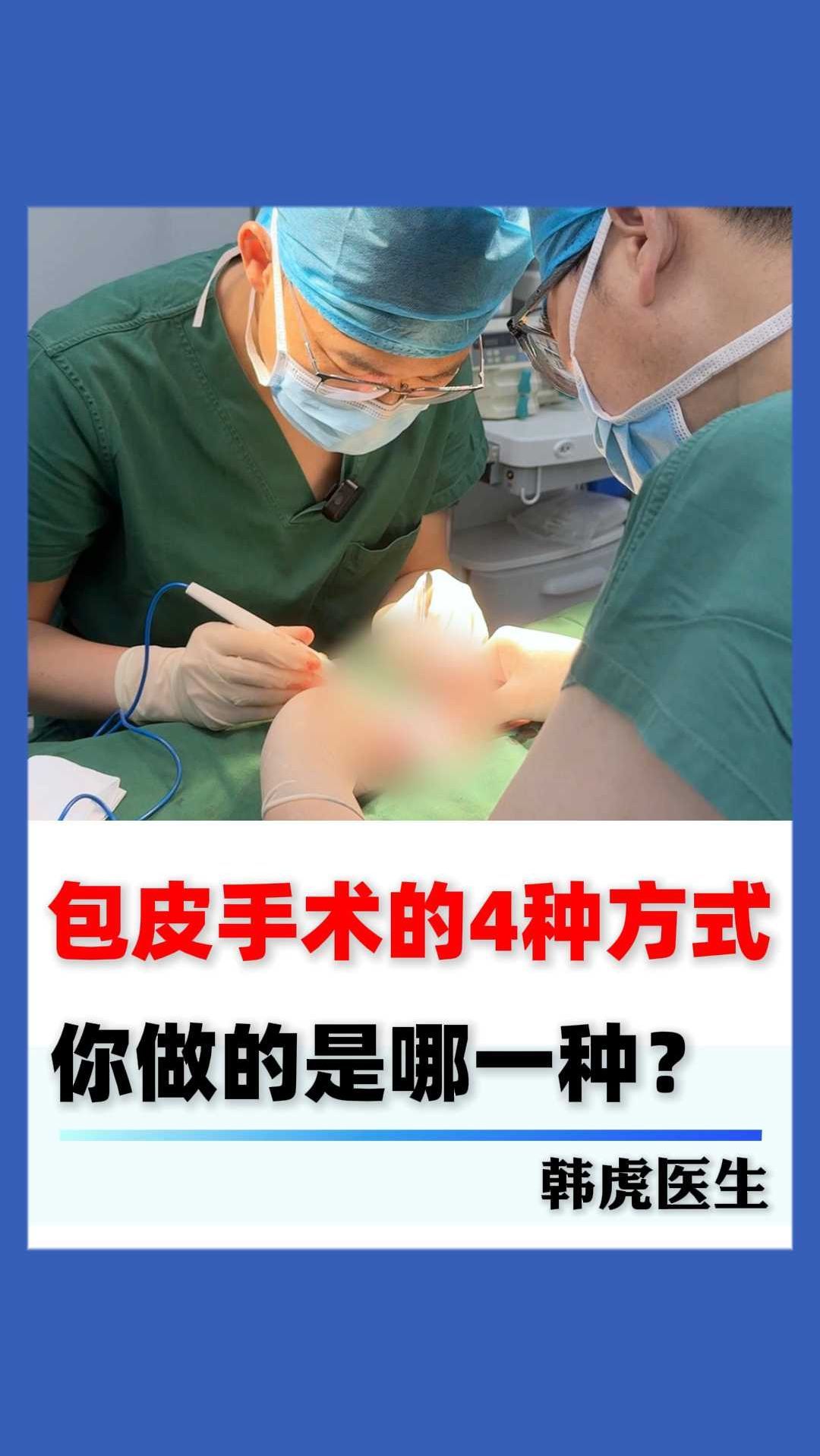 包皮手术的4种方式,你做的是哪一种?