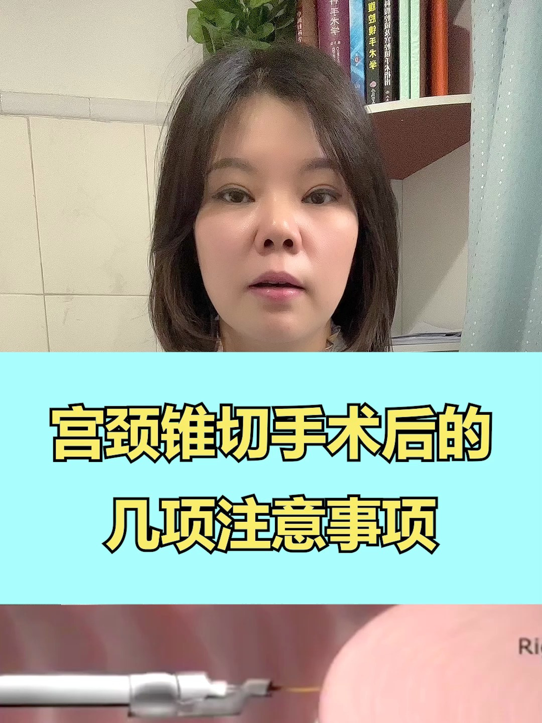 宫颈锥切手术的作用和危害,这些你要知道