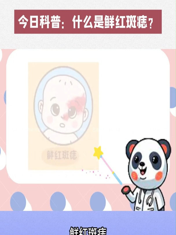 北京卫人胎记「今日科普」什么是鲜红斑痣?