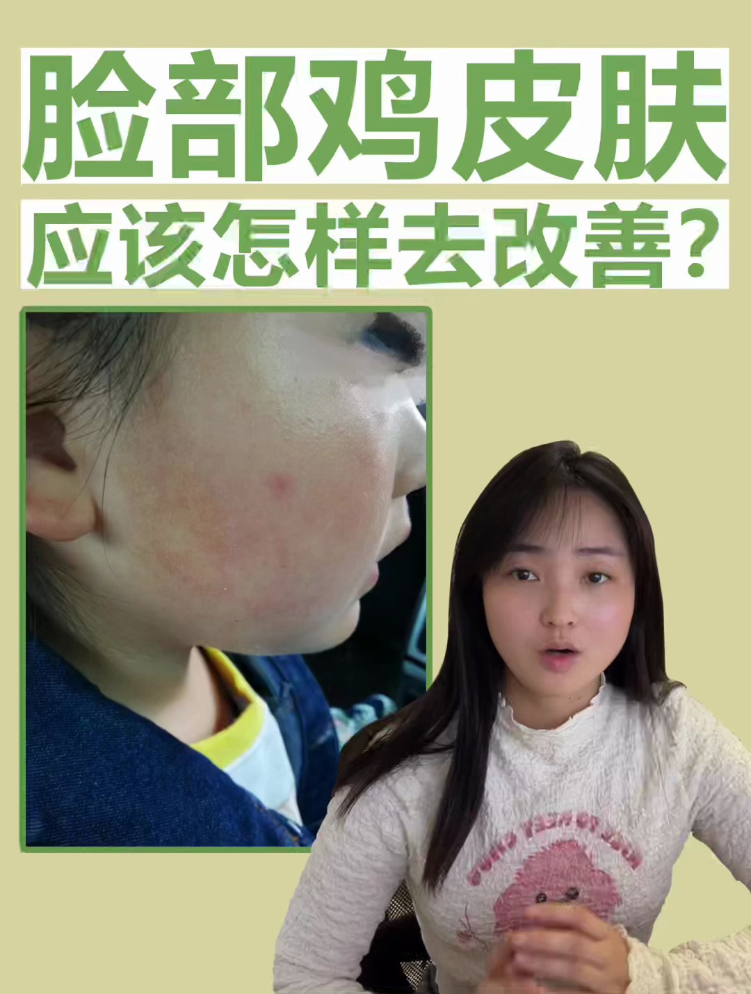 脸部鸡皮肤怎么去改善?