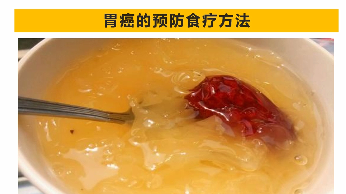 怎样预防胃癌减少危害?用这些食疗方法,试一试效果吧