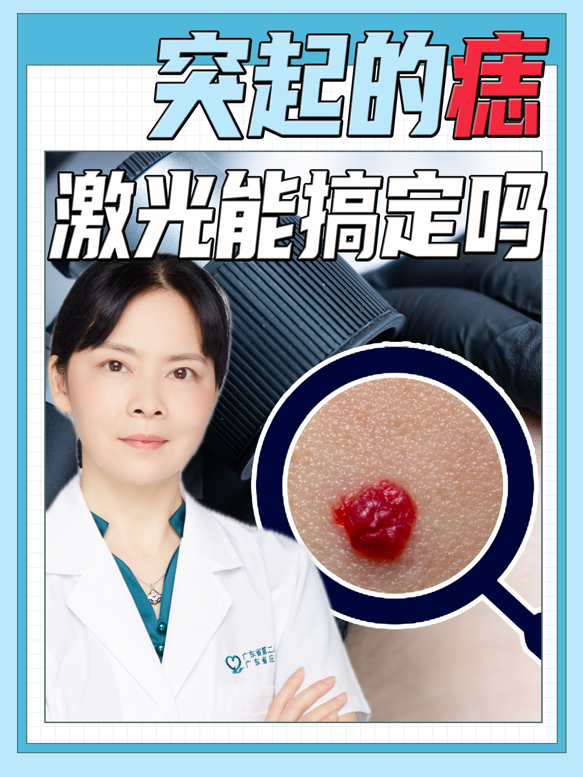 凸起的痣可以激光去掉吗?可以考虑,但出现这几种情况就要手术了