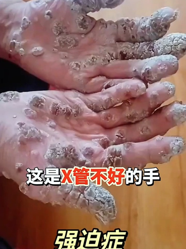 解密磷虾油的神奇功效:再堵的血管也怕他