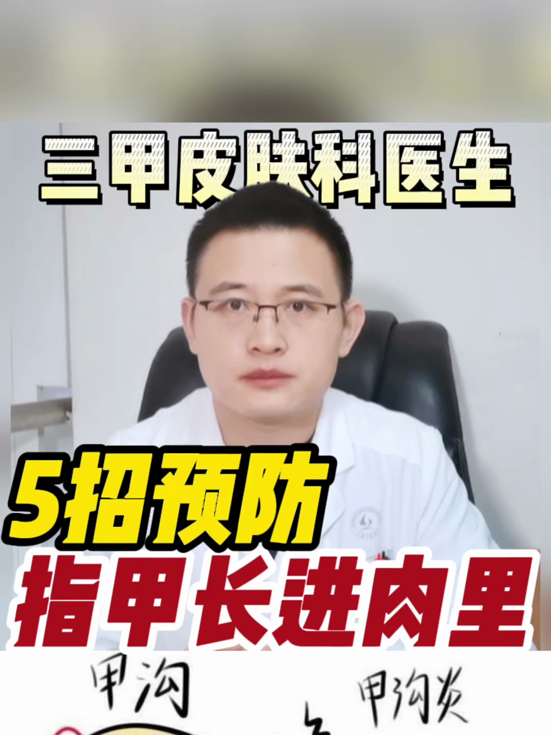 指甲长到肉里不用怕5个预防小妙招