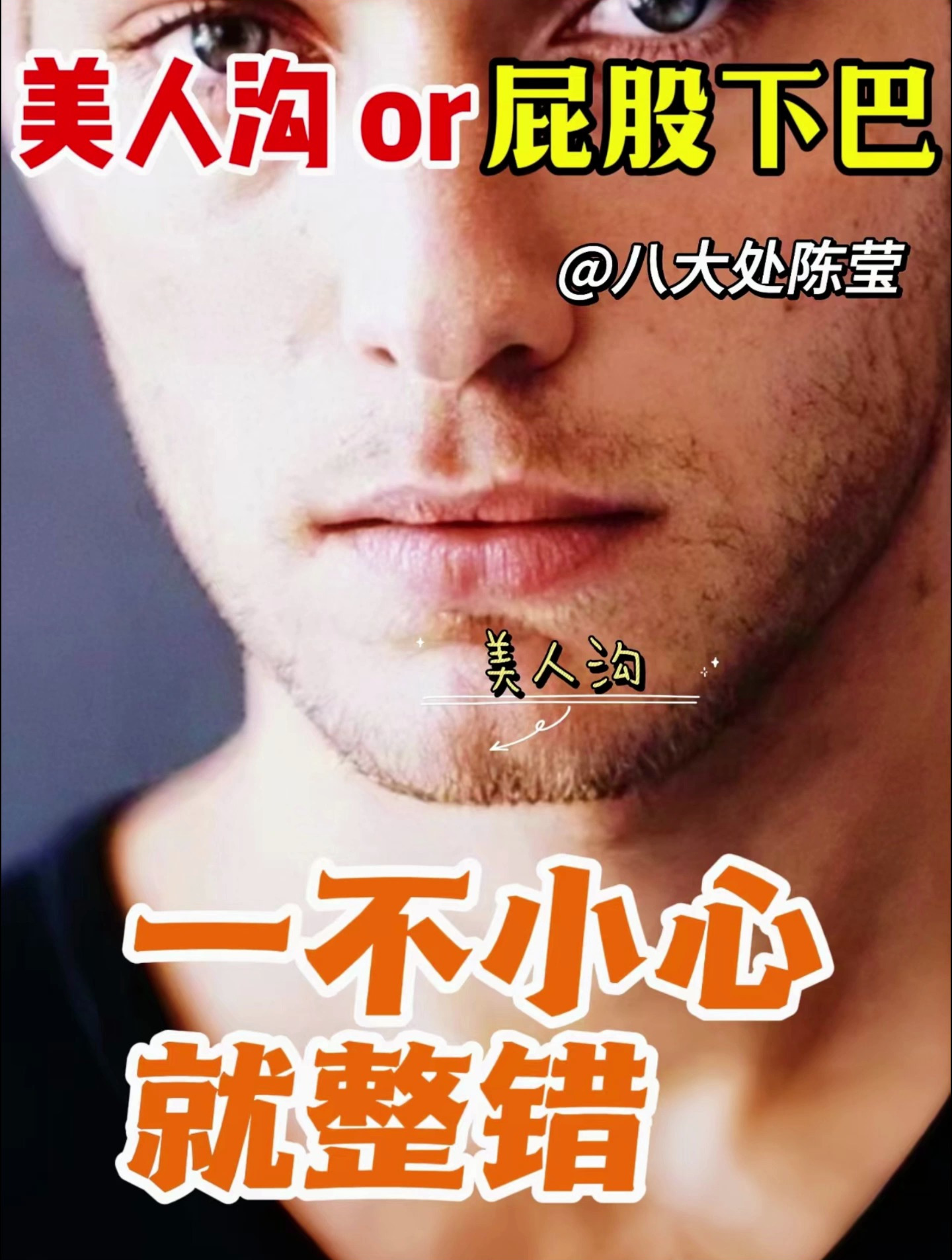 屁股下巴要不要整?看看你的五官有没有这些特征