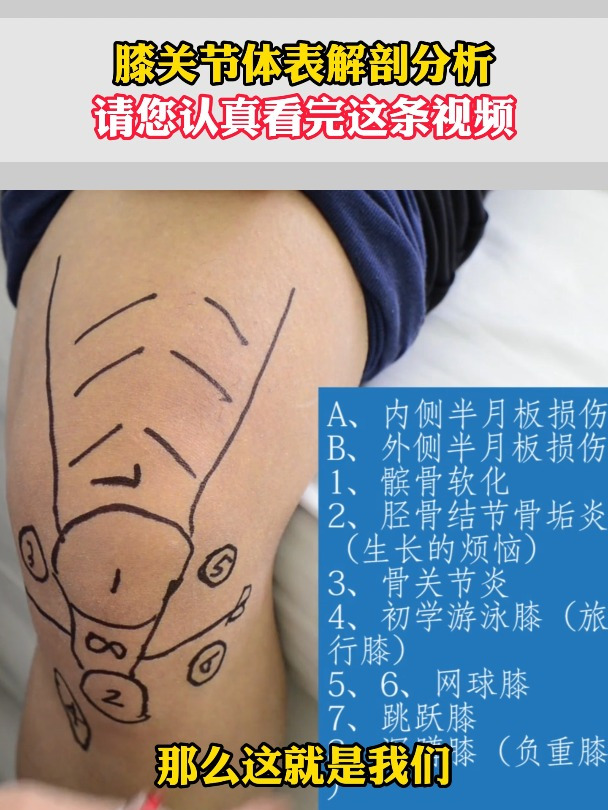 膝关节体表解剖分析,大家过来了解下你的膝关节