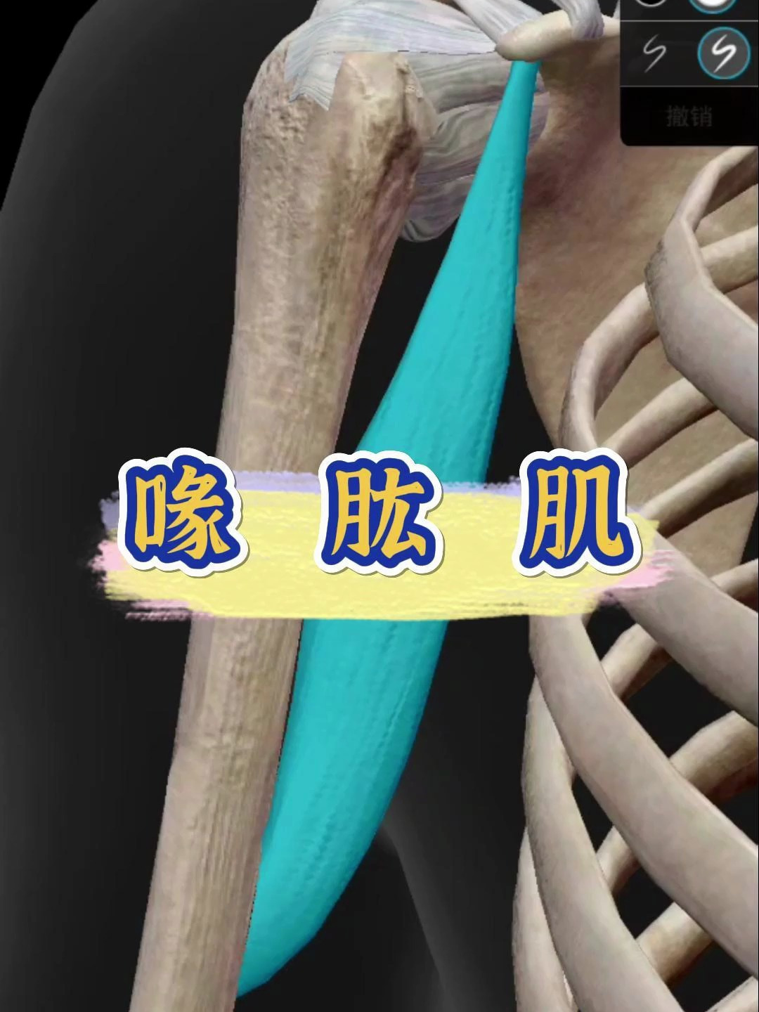 肌肉劳损松解放松:喙肱肌