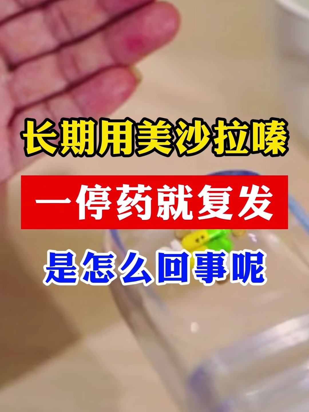一直用美沙拉嗪,一停药就复发是怎么回事呢?