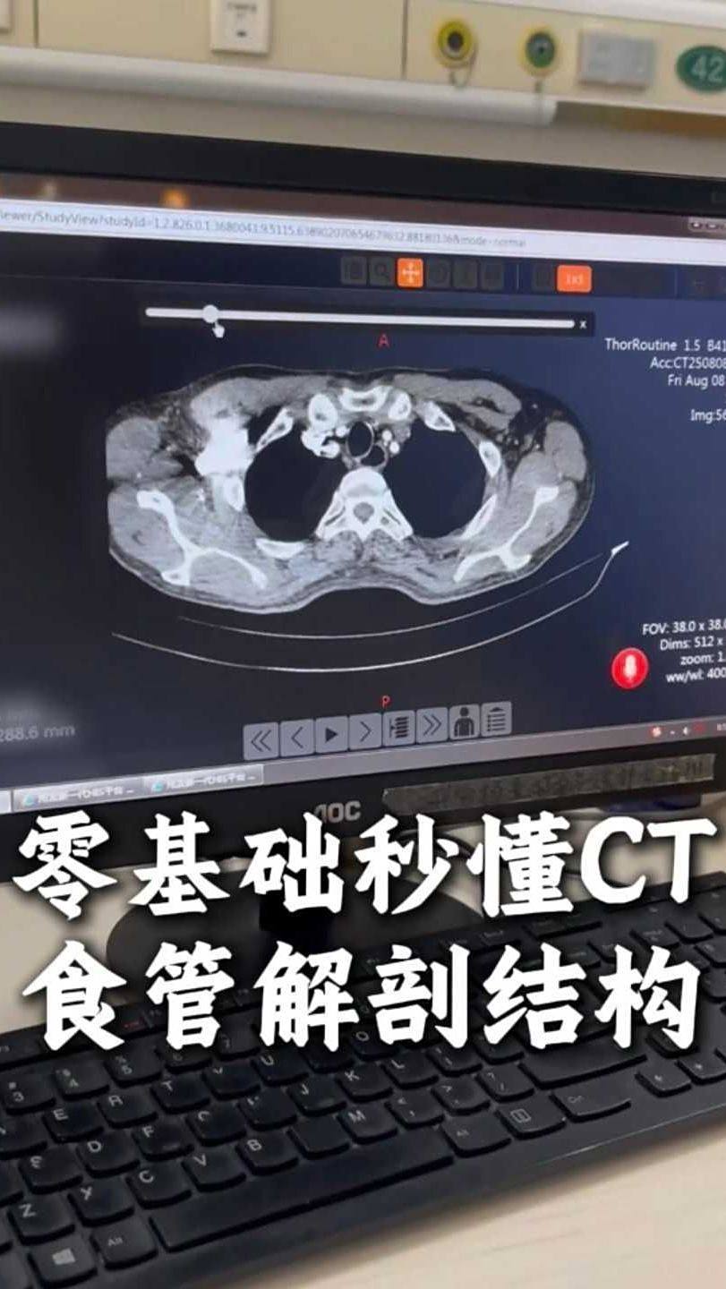 零基础秒懂CT食管解剖结构