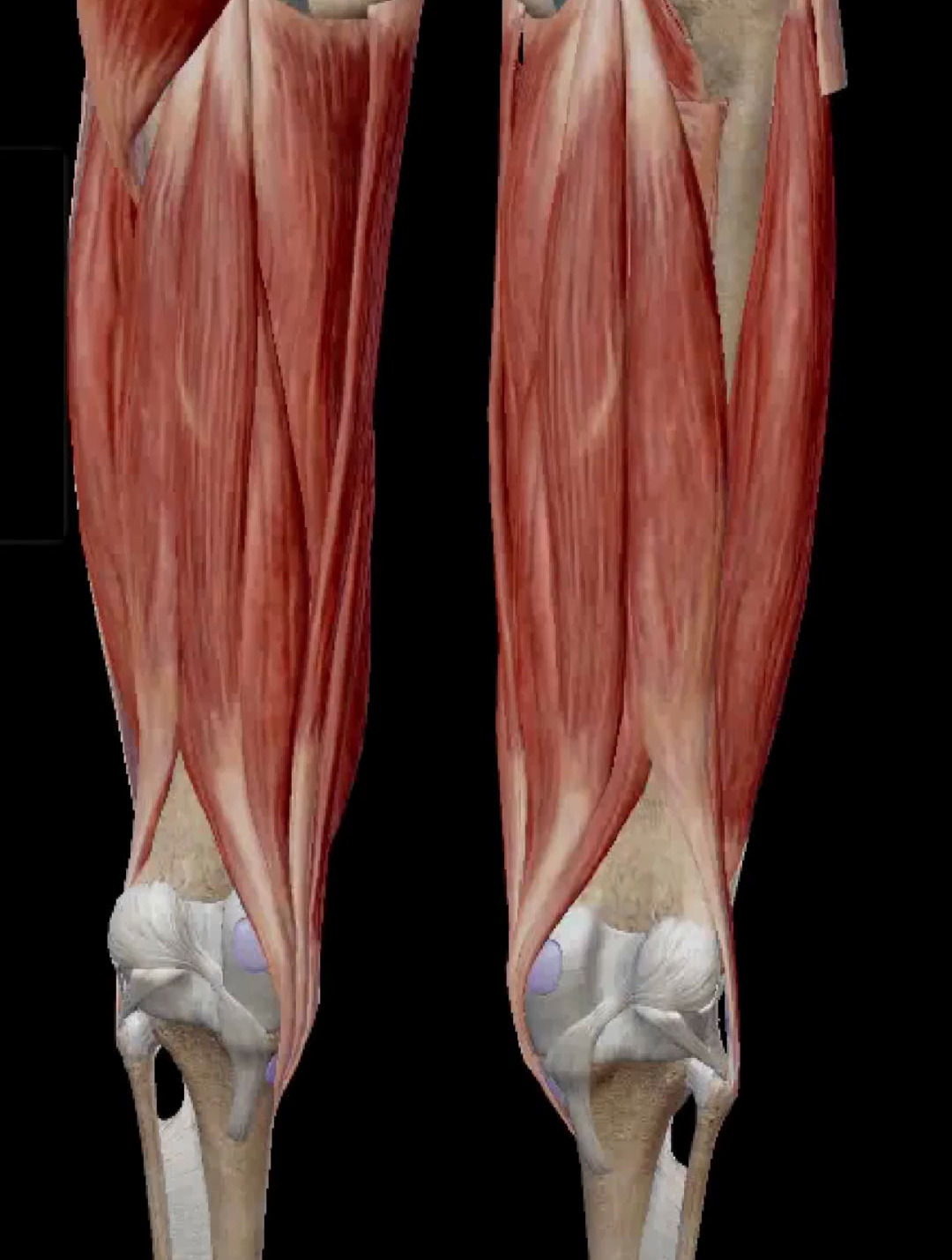 大腿后侧痛记得找他,腘绳肌