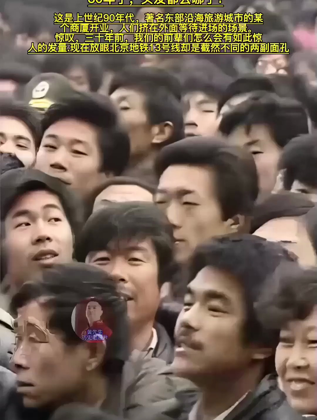 以前很少有秃顶,为什么现在这么多秃顶掉头发的呢?