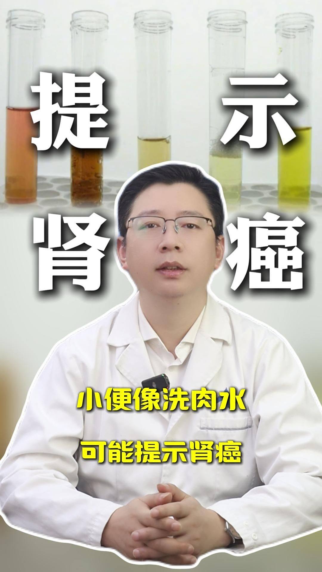 小便像洗肉水?可能提示肾癌?