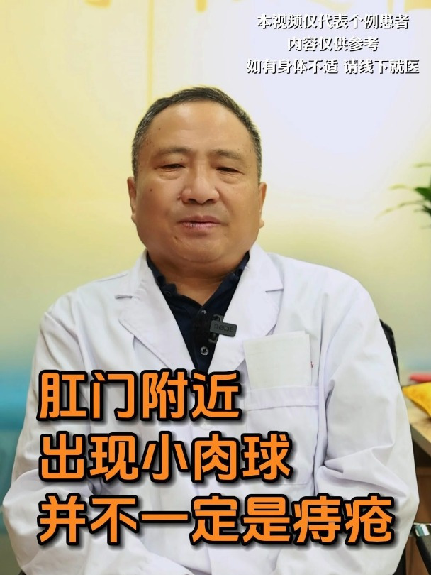 肛门附近出现小肉球,并不一定是痔疮