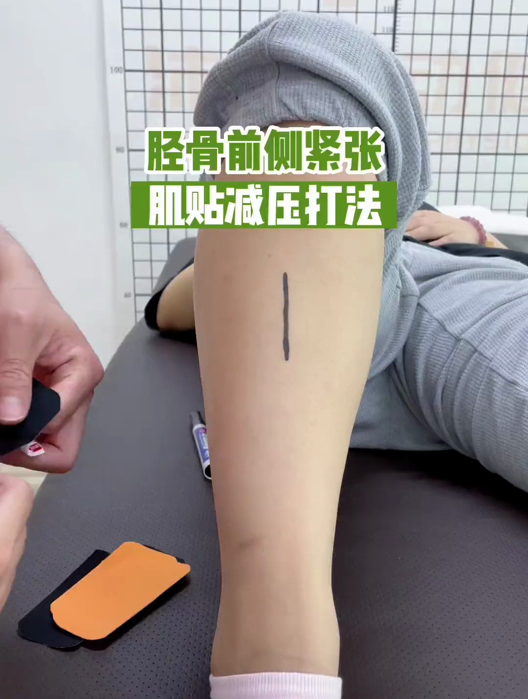 经常跑步,小腿胫骨前侧紧张,肌贴减压打法