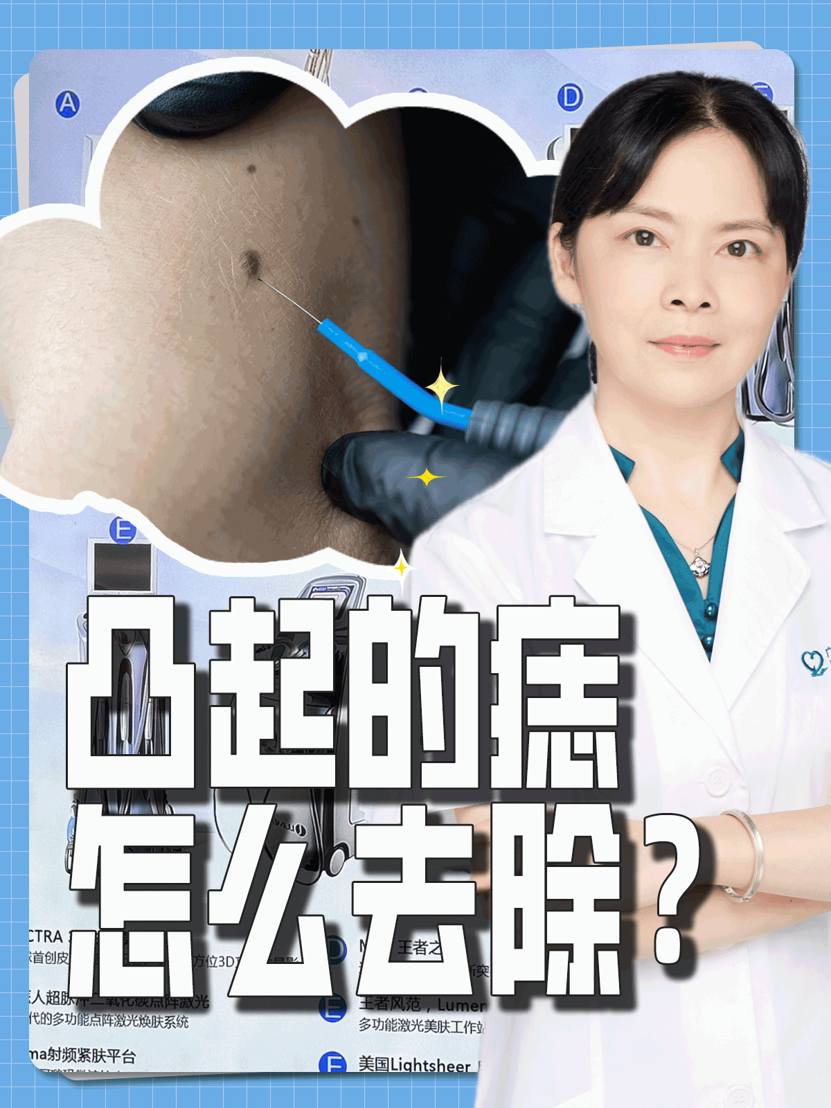 凸起的痣怎么去除?激光和手术都可以考虑,但首先查清是什么性质