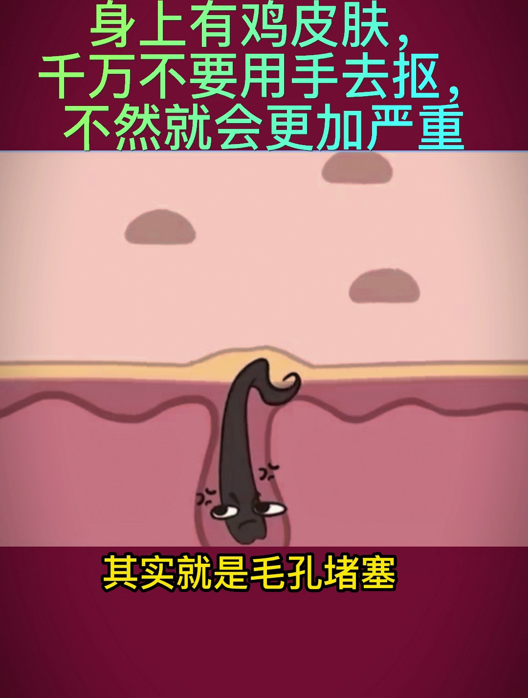 身上有鸡皮肤,千万不要用手去抠,不然就会更加严重
