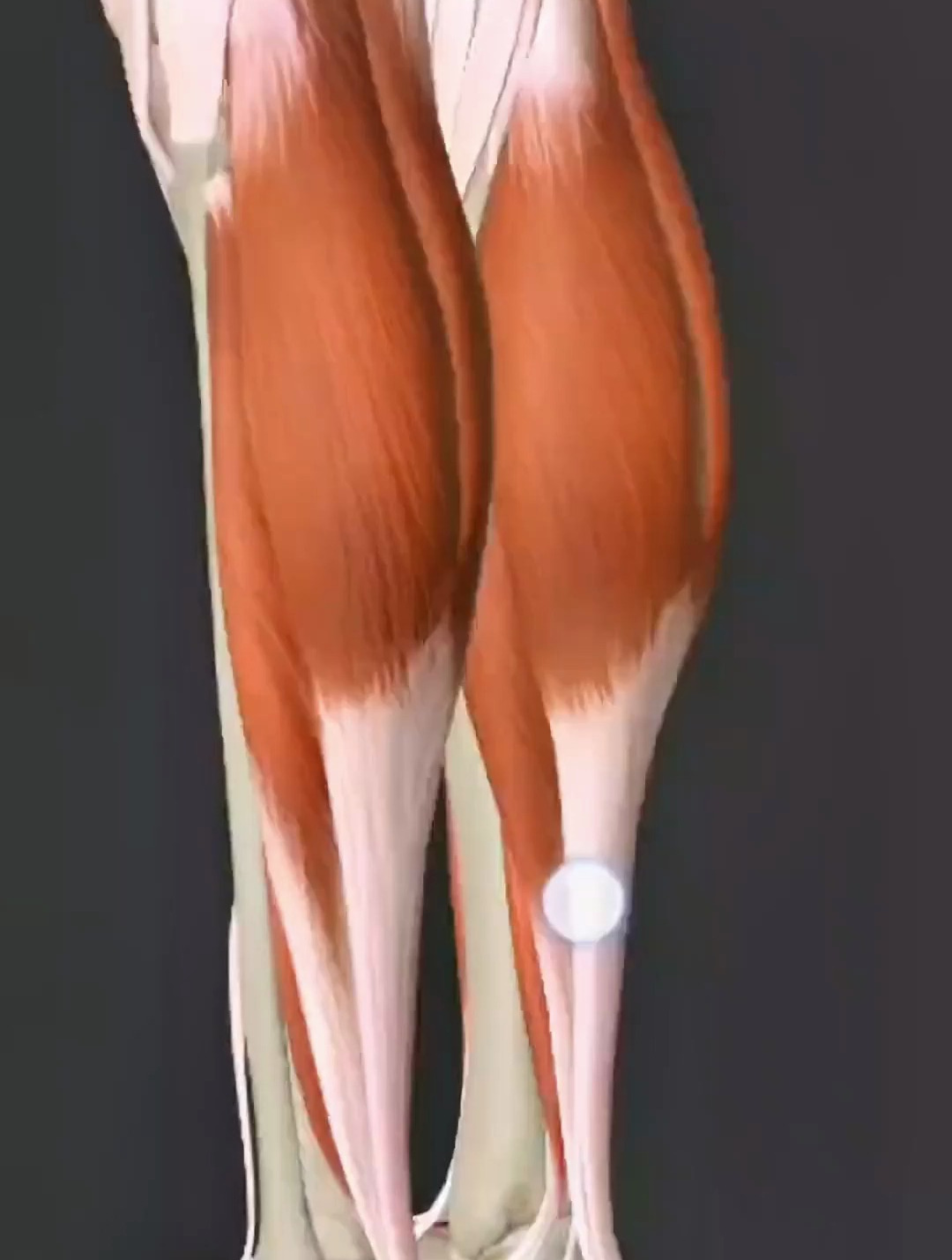 小腿后侧比目鱼肌讲解