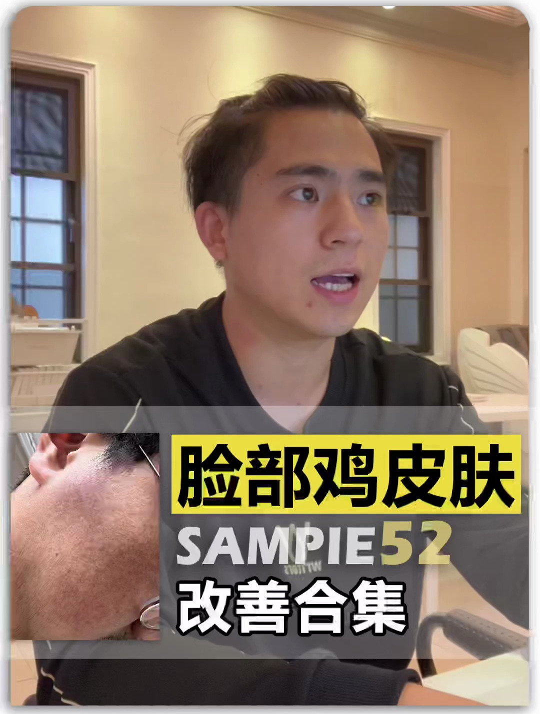 脸部鸡皮肤改善!