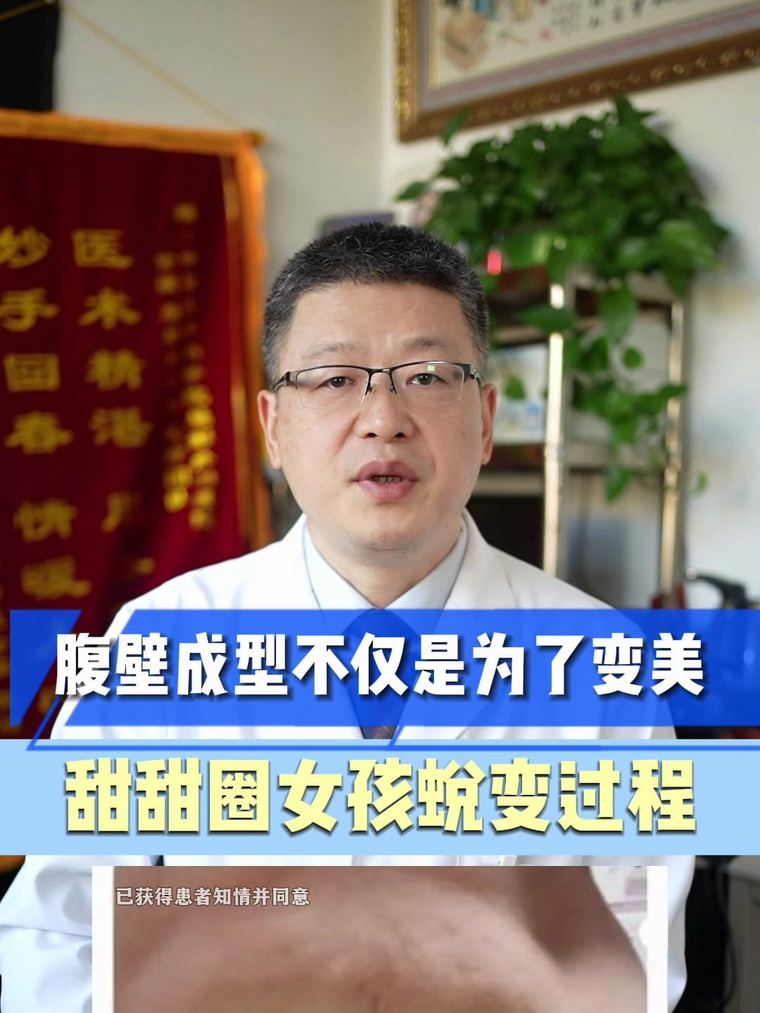 腹壁成型不仅是为了变美,甜甜圈女孩蜕变过程