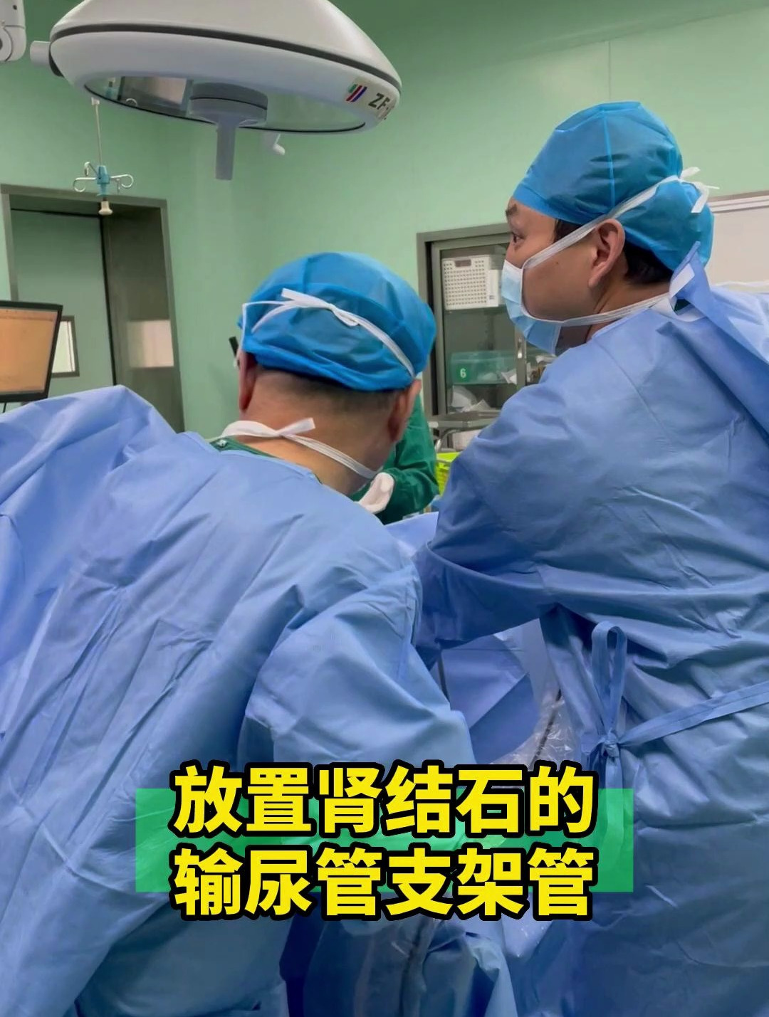 科普一下放置肾结石的输尿管支架管