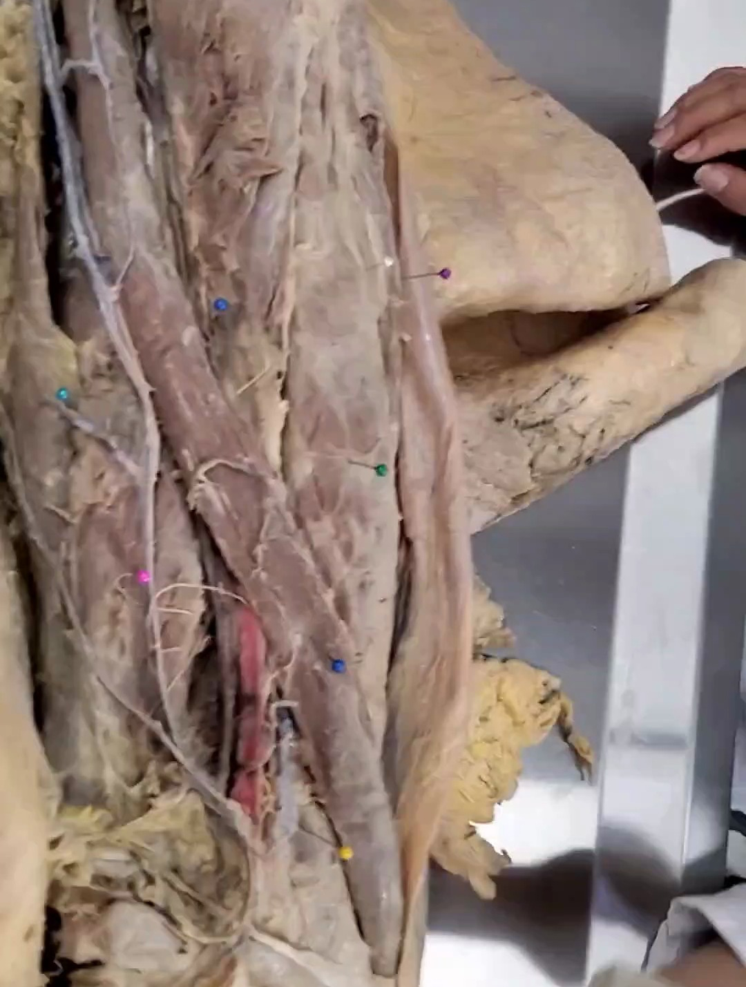 人体结构:大腿的肌肉