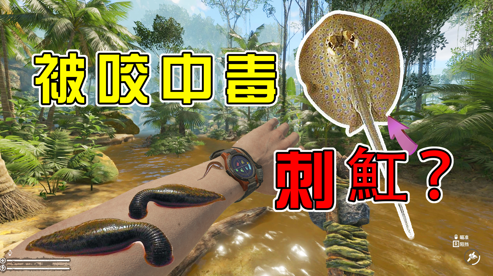 绿色地狱05:被未知生物咬中毒,我怀疑是刺魟,以后走水路要小心