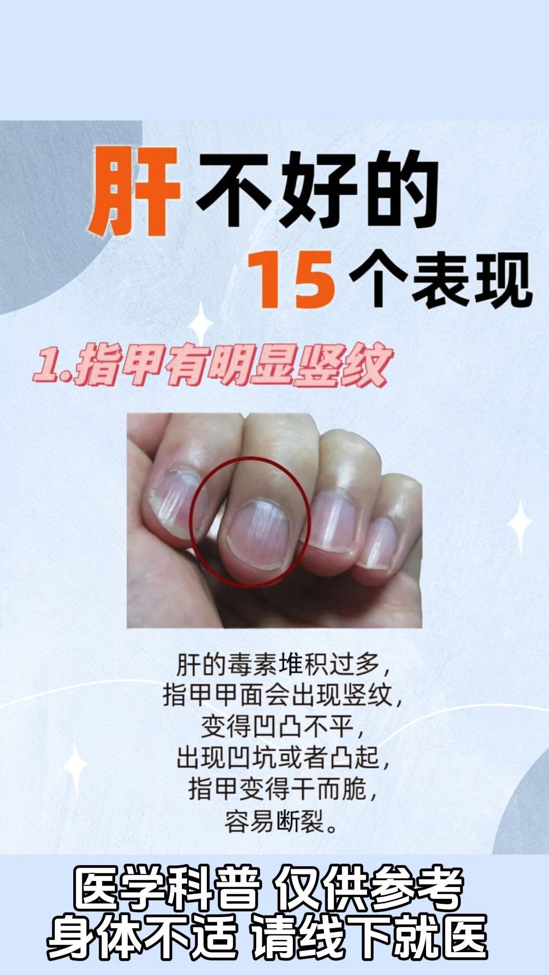 别忽视:肝脏不好?这15个常见症状你中了几个?