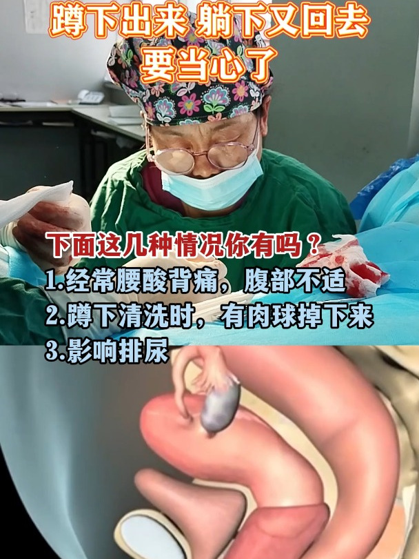 阴道口有一块肉是什么原因导致的?你有这种情况吗?