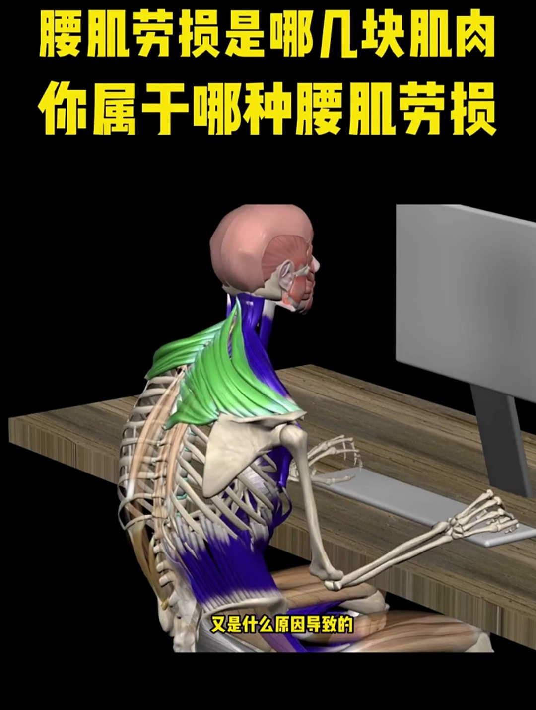 腰肌劳损是哪几块肌肉