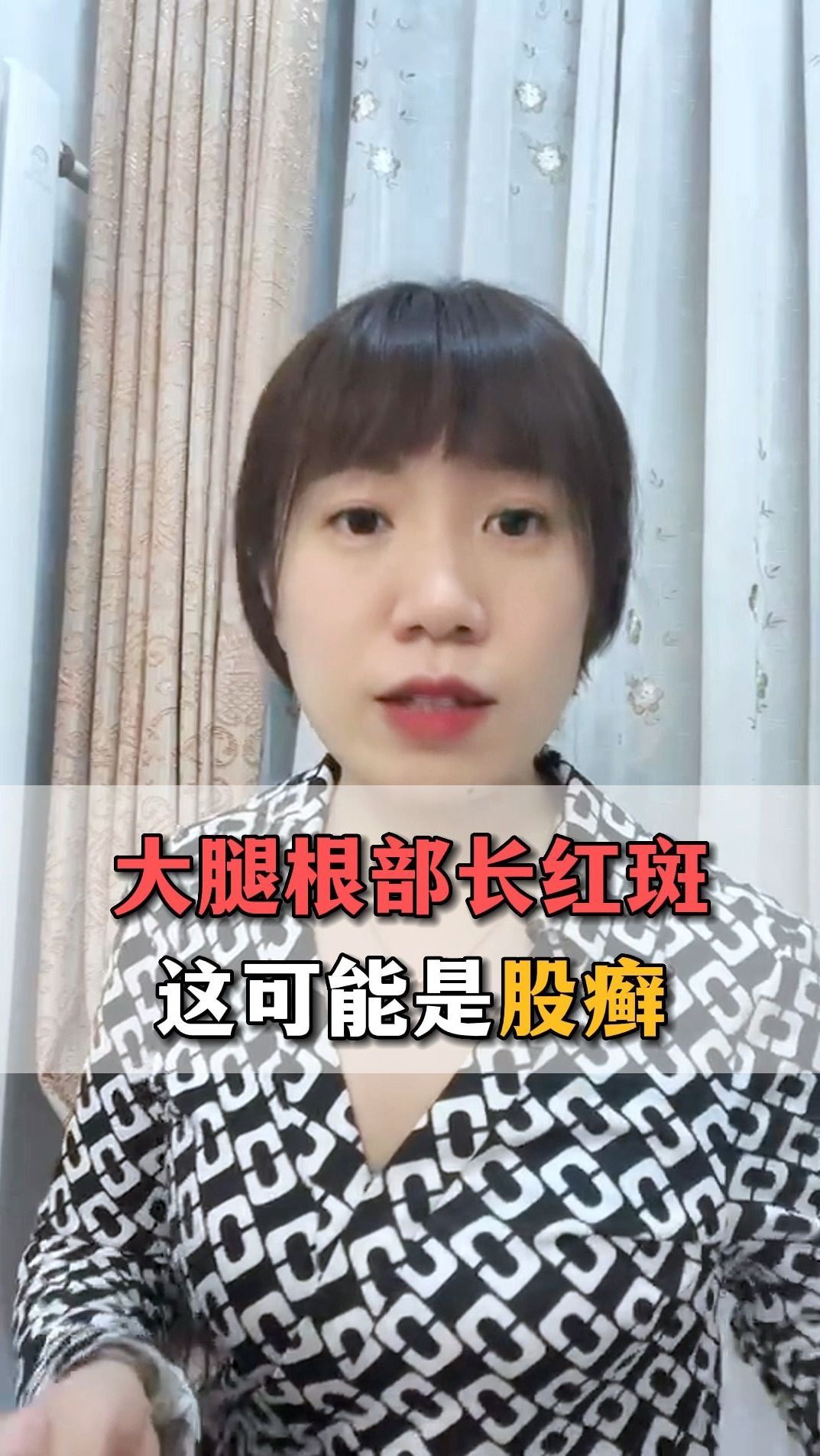 大腿根部长红斑这可能是股癣