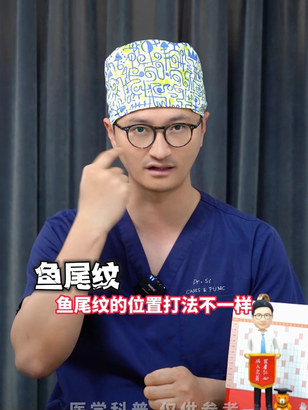 全面部肉毒素注射,一般都是打在哪?