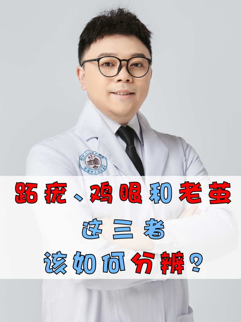 跖疣、老茧与鸡眼,三者傻傻分不清?一条视频讲清楚,请细看!